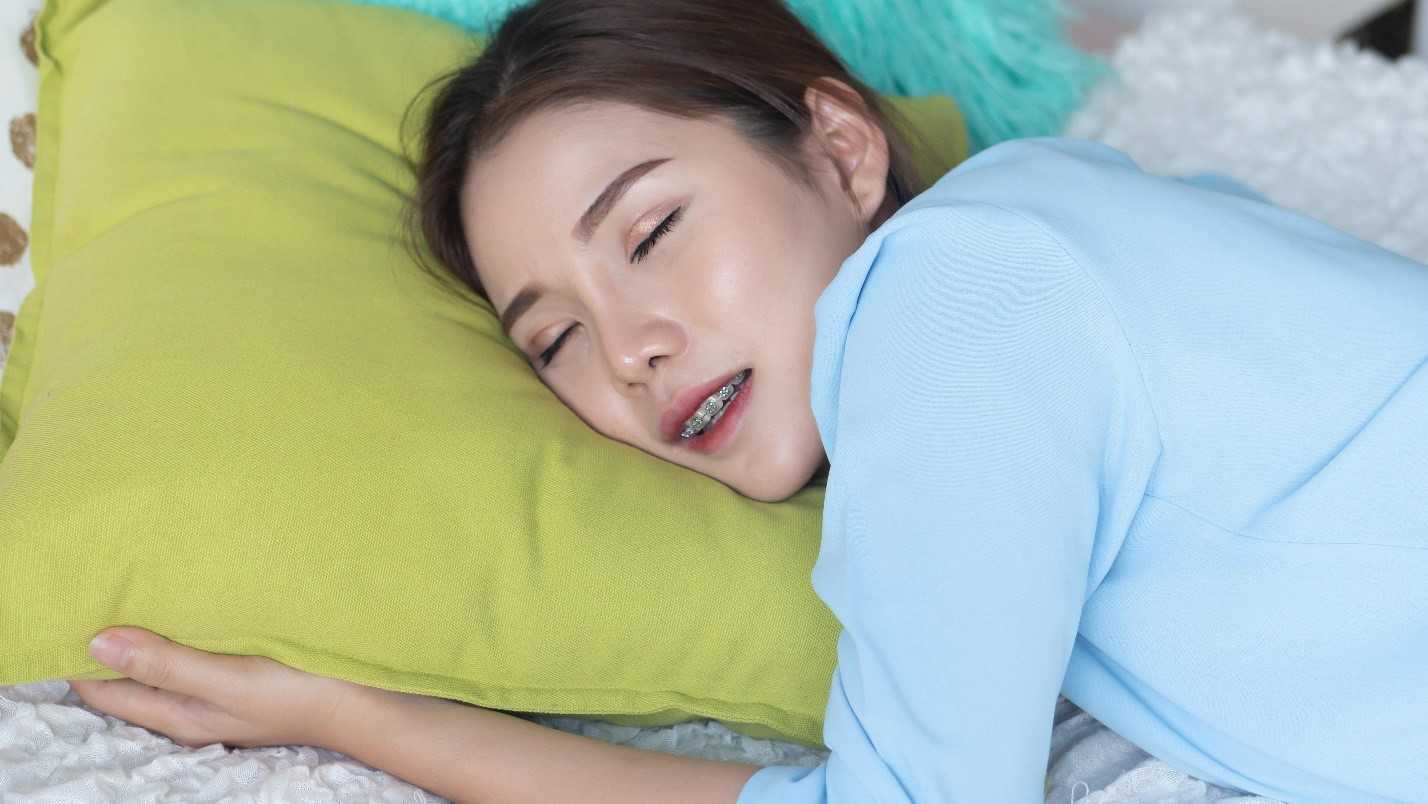 Can You Sleep with Orthodontic Wax?