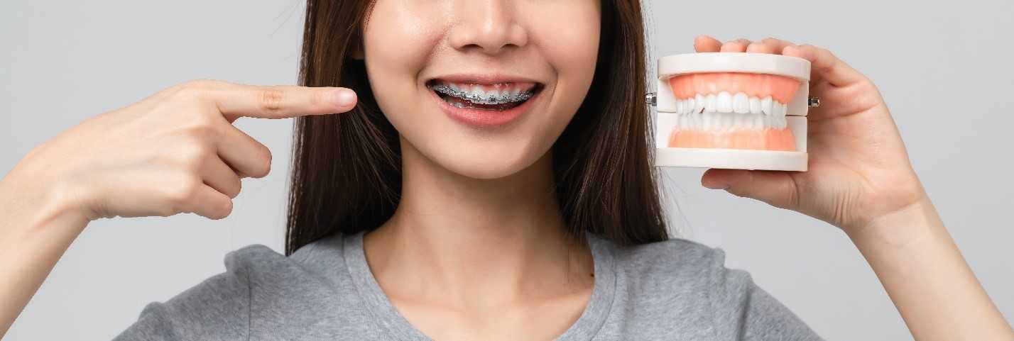 Woman Points At Braces And Shows Aligned Teeth Model In Other Hand